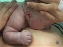 Skin to Skin in the First Hour After Birth